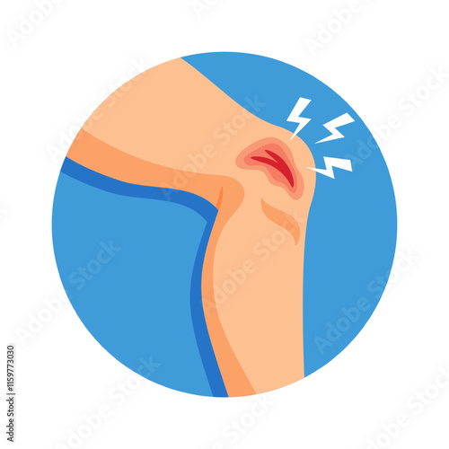 Bleeding wound on knee vector illustration