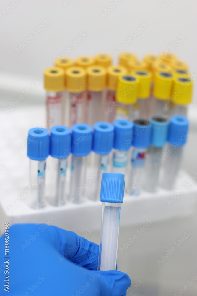 A tube with a biological sample is placed in a tray for research. A tube with a biological sample is placed in a tray for research.