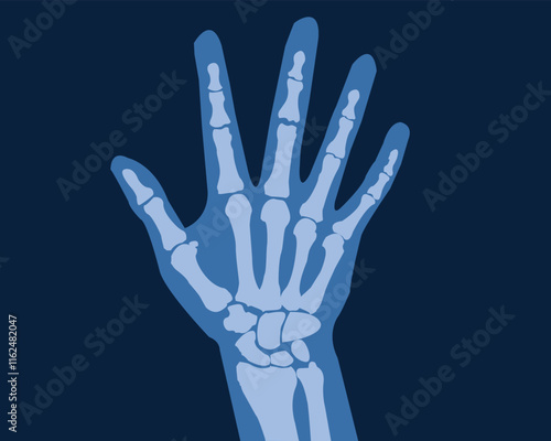 human hand x ray