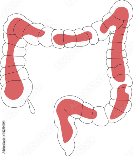 One line healthcare concept with bright spot. Healthcare vector illustration linear. Silhouette of intestine anatomy symbol. Isolated on white background. gastroenterology