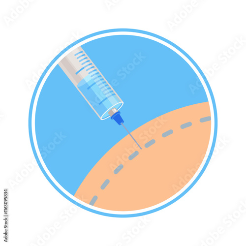 Local anesthesia hair transplantation step