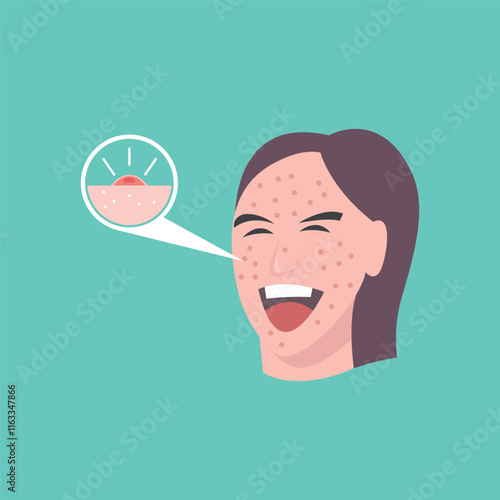 cartoon women with acne facial problems vector element design