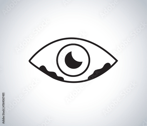 Stringy discharge from the eyes refers to mucus-like strands that may accumulate in or around the eyes