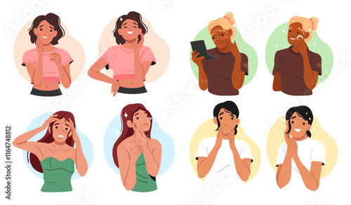 Woman characters with different face skin area problem and care, treatment procedure isolated set