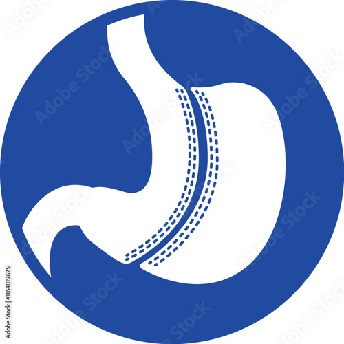 Illustration of stomach icon with bariatric surgery procedure, anatomy. Ideal for medical and educational materials