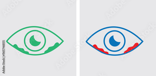 Stringy discharge from the eyes, often described as mucus-like strands, can be a sign of several eye conditions