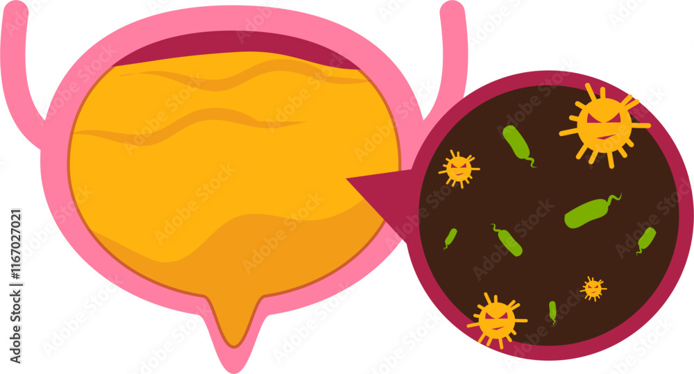 bladder disease. Urinary tract infection Illustration bladder disease. Urinary tract infection Illustration