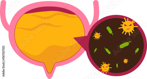 bladder disease. Urinary tract infection Illustration