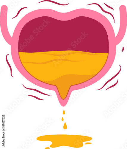 bladder disease. Urinary tract infection Illustration