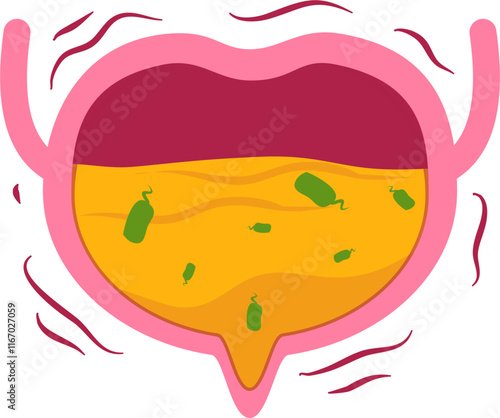 bladder disease. Urinary tract infection Illustration