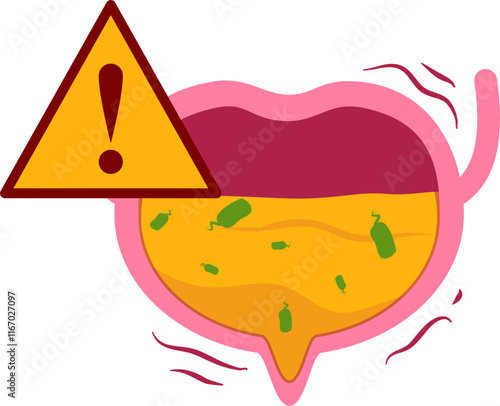 bladder disease. Urinary tract infection Illustration