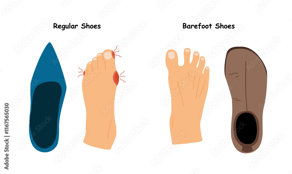 Barefoot Shoes. Feet with Bunions. Compare regular narrow shoes and barefoot shoes. Tight shoes and heels lead to problems with the feet, bone deformation, redness and inflammation Barefoot Shoes. Feet with Bunions. Compare regular narrow shoes and barefoot shoes. Tight shoes and heels lead to problems with the feet, bone deformation, redness and inflammation