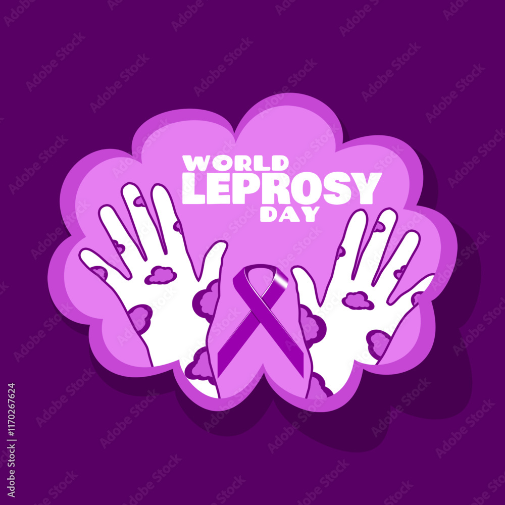 World Leprosy Day to celebrate on last Sunday in January. Illustration of two hands affected by leprosy with a purple campaign ribbon on a dark purple background. Health event banner.