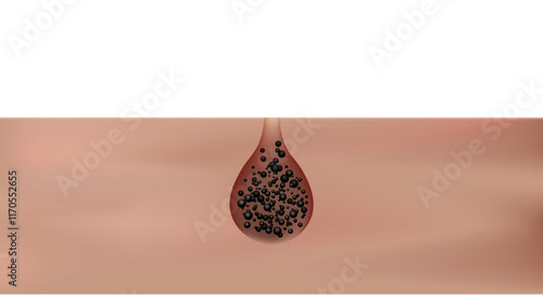 Dirty pore, main trouble of blackhead and acne. Skin treatment, large pores 3D rendering