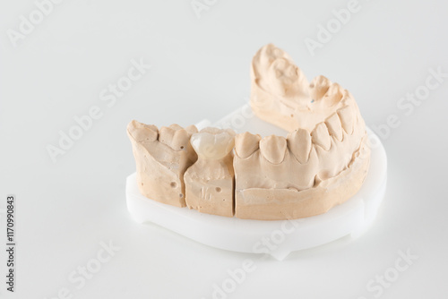 dental crown made of ceramics