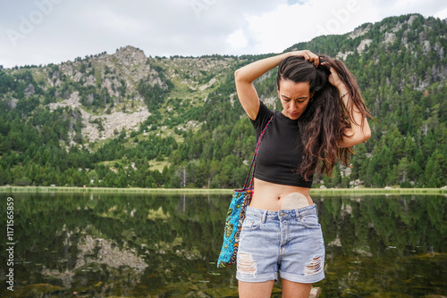 Woman with ostomy enjoys nature with confidence and freedom photo