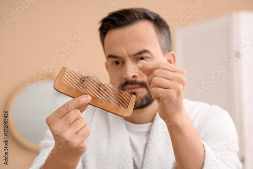 Handsome man with hair loss...