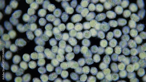 Larvae of a polychaete worm Phyllodoce sp. at trochophore stage under microscope. Family Phyllodocidae. Larva has a ciliary girdle, thanks to which it swims in water column. White sea