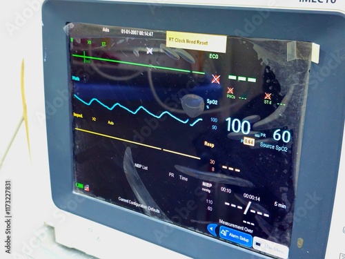 Cairo, Egypt, December 31 2024: Vital signs medical monitor for measurement of important vital signs for patients, like arterial blood pressure, heart rate or pulse and Spo2 oxygen saturation