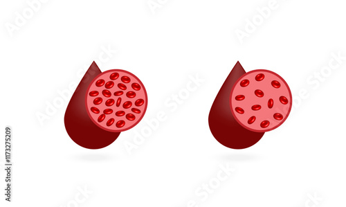 Iron deficiency anemia. Blood donation. Realistic vector 3d picture. Vector illustration isolated on white background.	