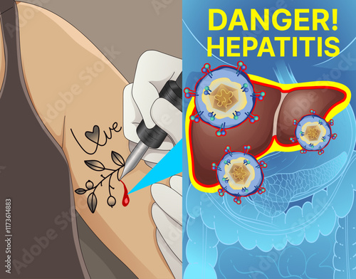 Human liver disease. Hepatitis. The risk of hepatitis spread. The risk of hepatitis infection. Healthcare illustration. Vector illustration.