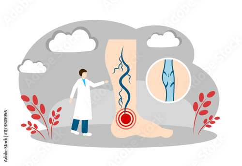 Varicose veins. Healthcare and Medicine Concept