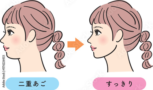 二重あごが解消された若い女性