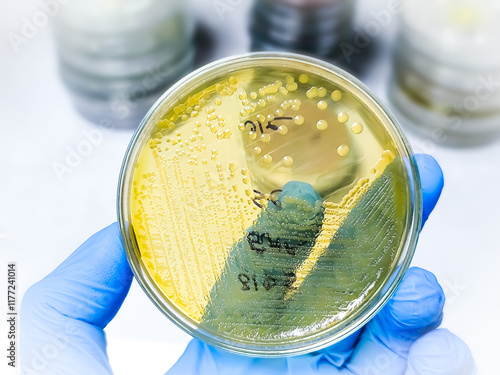 Scientist hand holding petri dish with colony of Proteus bacteria, a type of gram-negative bacteria that can cause a variety of infections, including UTI. photo