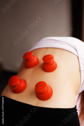 doctor performs vacuum back massage on patient. Silicone jars. woman physiotherapist gives vacuum cupping massage