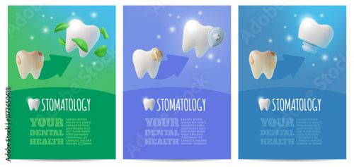 Your dental health advertising poster 3D vector set, bad and good conditions of tooth or implant, stomatology service