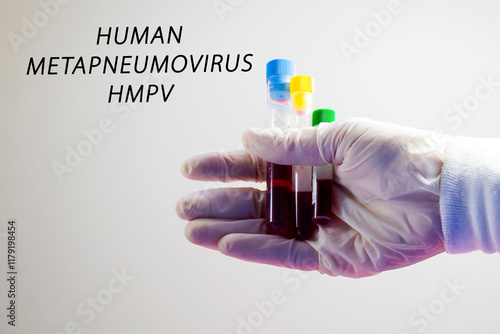 Human Metapneumovirus, HMPV virus photo