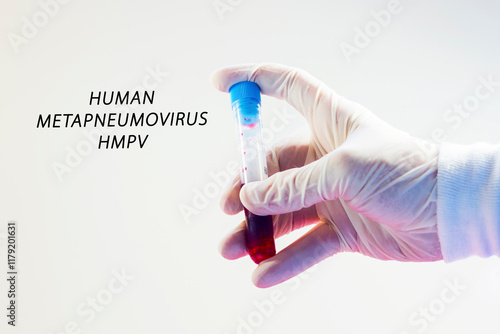 Human Metapneumovirus, HMPV virus photo