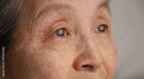 여성 어르신의 신체 눈 클로즈업 (백내장) _ 노안