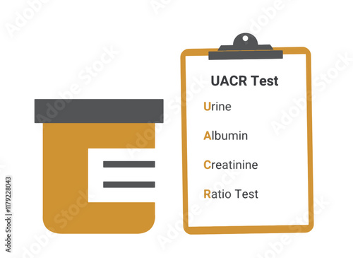 Urine Sample for Urine ACR (albumin to creatinine Ratio) test for diagnosis of chronic kidney disease (CKD). The Urine Albumin to Creatinine Ratio (UACR) test checks the urine for kidney problems.
 photo