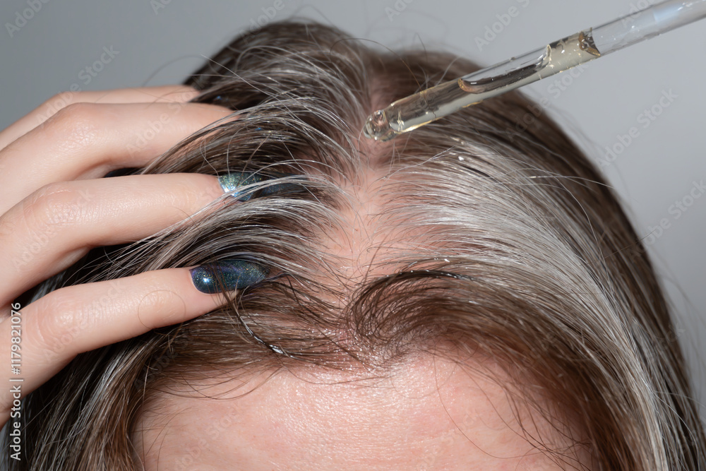 Obraz premium Photo of a hair part with a pipette applying an acid peel or serum to the scalp: A close-up shows the parting of hair, where brown and silver strands intertwine.