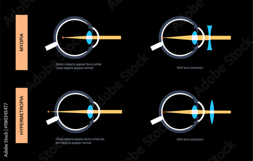 Farsightedness and nearsightedness correction