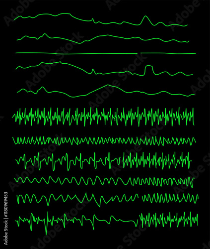 Collection of electrocardiogram lines to indicate the function of the heart. Emphasizing the complexity and beauty of the electrocardiogram and conveying the heart's unstoppable function.