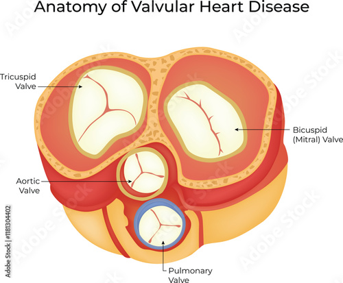 Anatomy of Valvular Heart Disease Science Design Vector Illustration