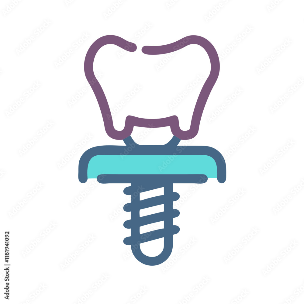 Stock Dental Implant Graphic for Clinics and Medical Use Stock Dental Implant Graphic for Clinics and Medical Use