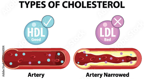 Understanding Good and Bad Cholesterol