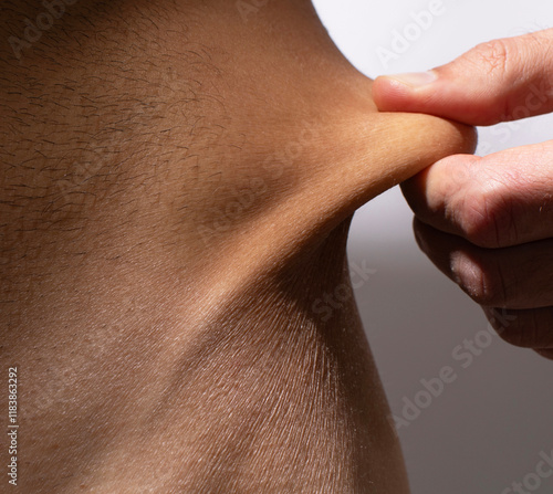 Fotografia Skin elasticity check. Fingers pinch and pull the skin, close up