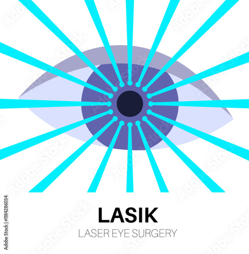 Lasik laser surgery