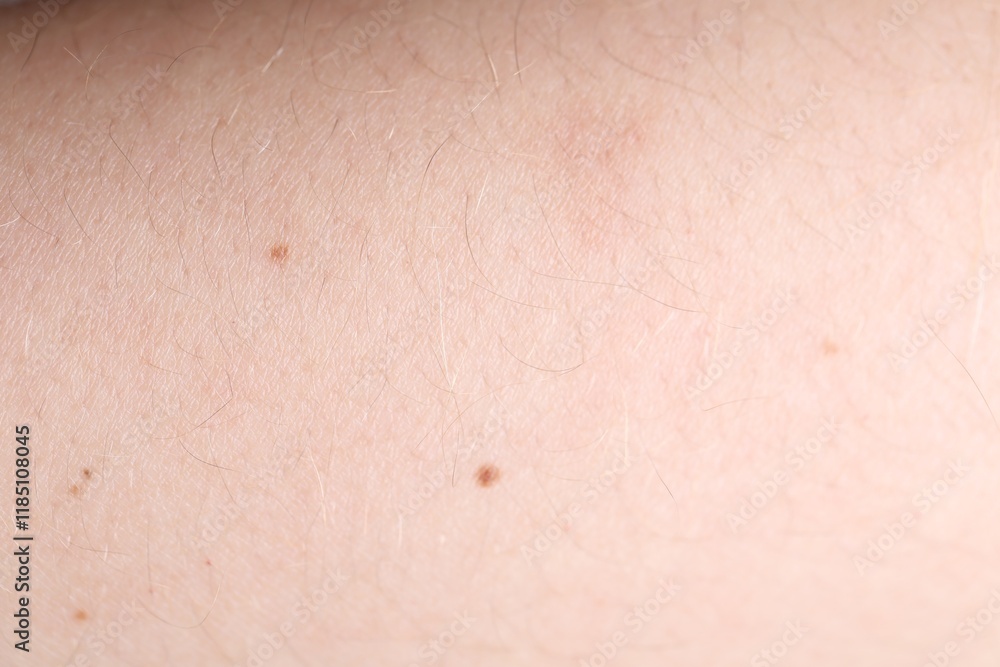 Texture of healthy skin as background, closeup Texture of healthy skin as background, closeup