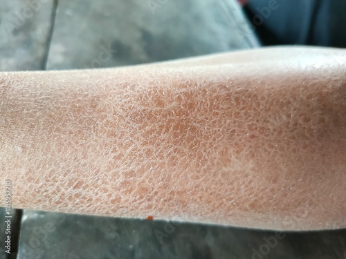 feet of a person with a bandage