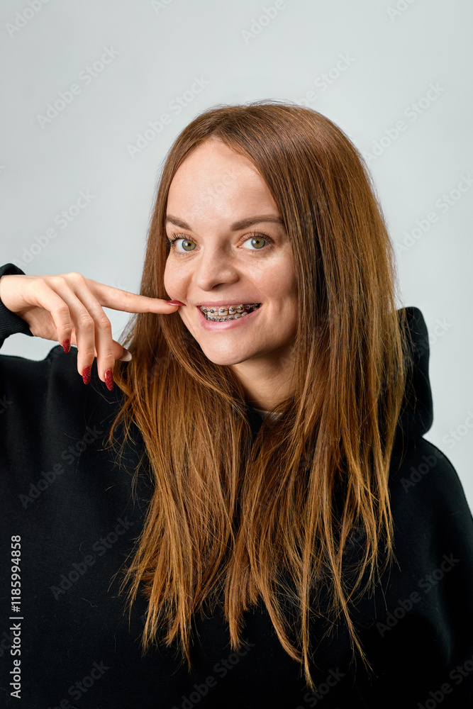 European woman makes faces with braces on her teeth European woman makes faces with braces on her teeth
