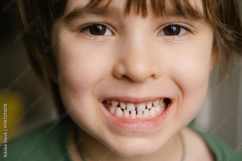Close-up headshot of little preschool cute boy widely smiling, showing the first baby milk teeth. Happy four or five years old small adorable cutie toddler with primary teeth. Portrait. Close-up headshot of little preschool cute boy widely smiling, showing the first baby milk teeth. Happy four or five years old small adorable cutie toddler with primary teeth. Portrait.