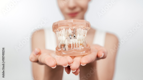 Doctor shows patient educational model of dental implant in clinic, close-up. White healthy perfect teeth plastic model. Implants, maxillary sinus lift, educational and explanatory materials, ads photo