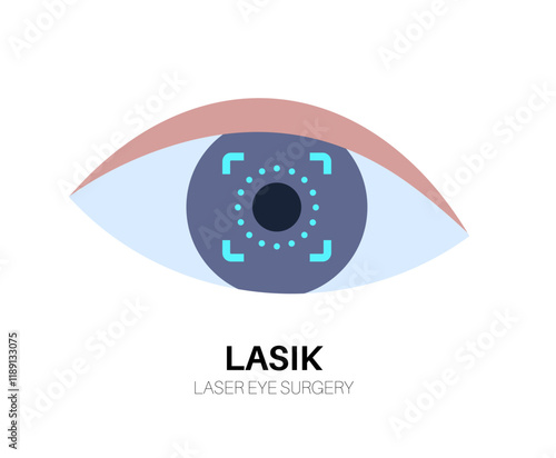 Lasik laser surgery