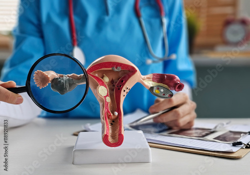 Doctor with Uterus and Ovaries anatomy model and magnifying glass. photo