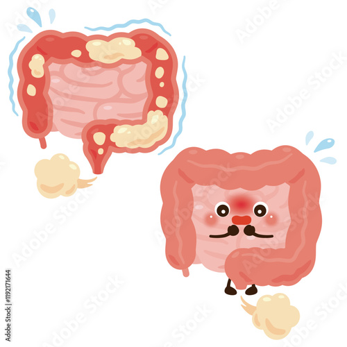 ガスが溜まった腸とオナラをする腸のキャラクター